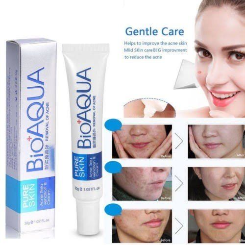 Bio aqua Acne Cream Face Skin Care Acne Anti-Wrinkle Removal Cream Spots Scar Blemish Marks 30g